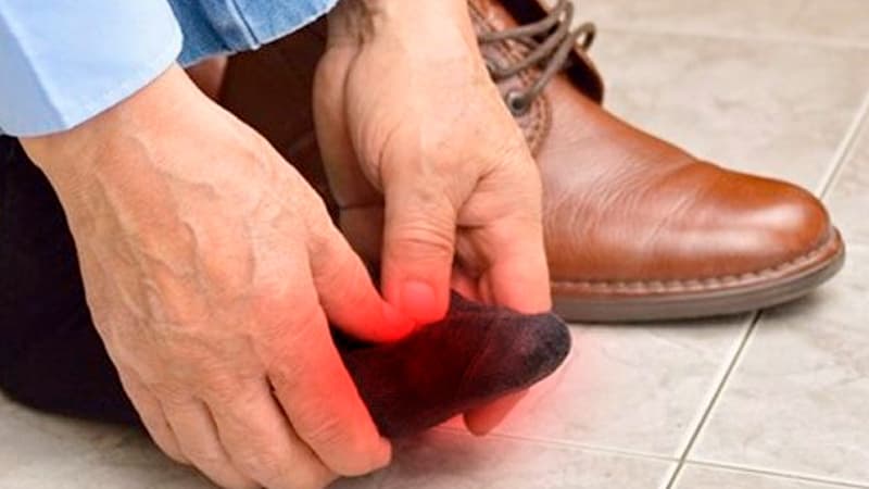 عوارض پوشیدن کفش‌های نامناسب: چرا انتخاب کفش مناسب اهمیت دارد؟